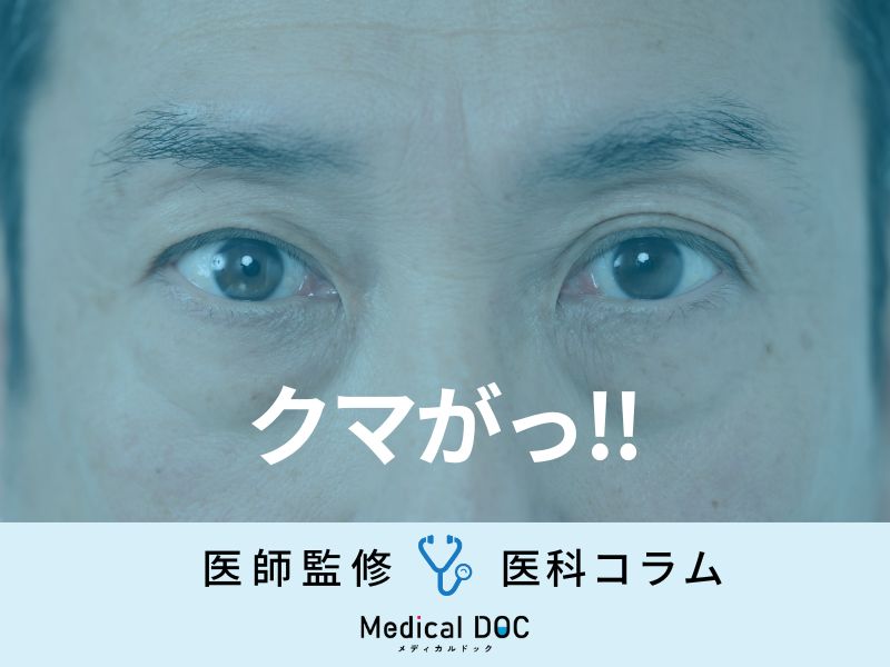 『クマ』の専門家が「どう対処すべきか」を解説 “黒クマ・茶クマ”対策とは