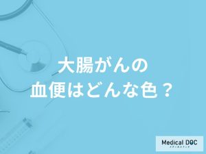 「大腸がんの血便」はどんな色かご存知ですか？医師が徹底解説！