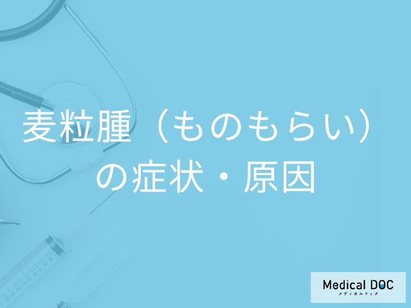 「麦粒腫（ものもらい）」の症状・原因・予防法はご存知ですか？医師が監修！