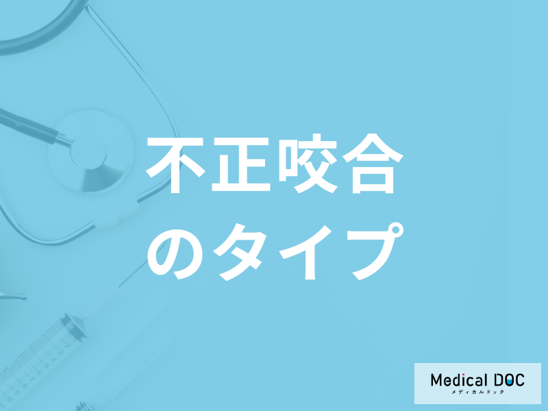「不正咬合」の原因となる3つの要素とは?出っ歯や八重歯などのタイプも解説!