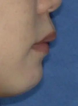 天神AN矯正歯科