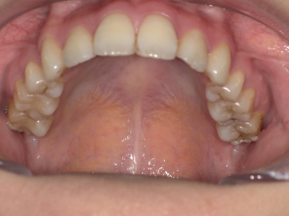 天神AN矯正歯科