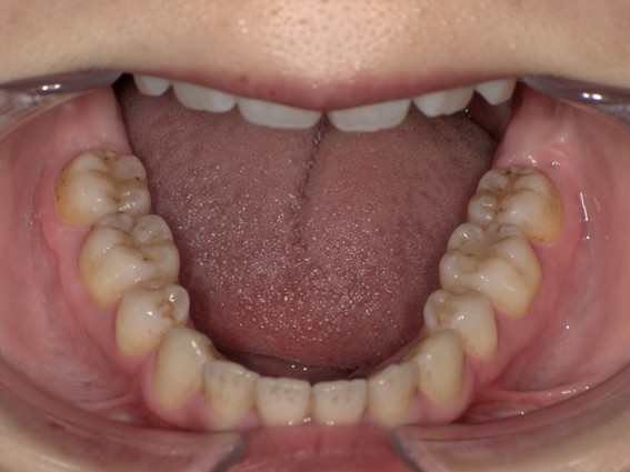 天神AN矯正歯科