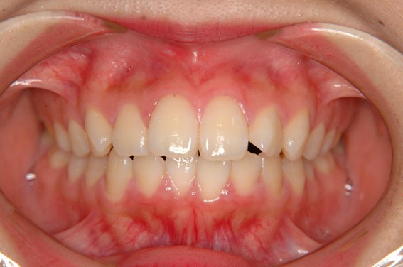 天神AN矯正歯科