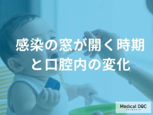 「むし歯菌の感染」で特に注意すべき時期とは？乳歯とむし歯のリスクを解説！