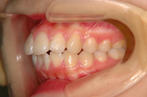 天神AN矯正歯科