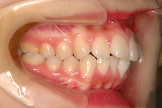 天神AN矯正歯科