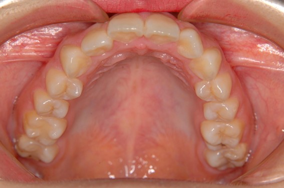 天神AN矯正歯科