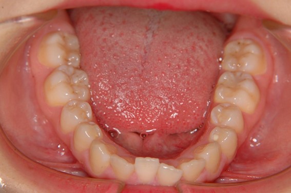 天神AN矯正歯科