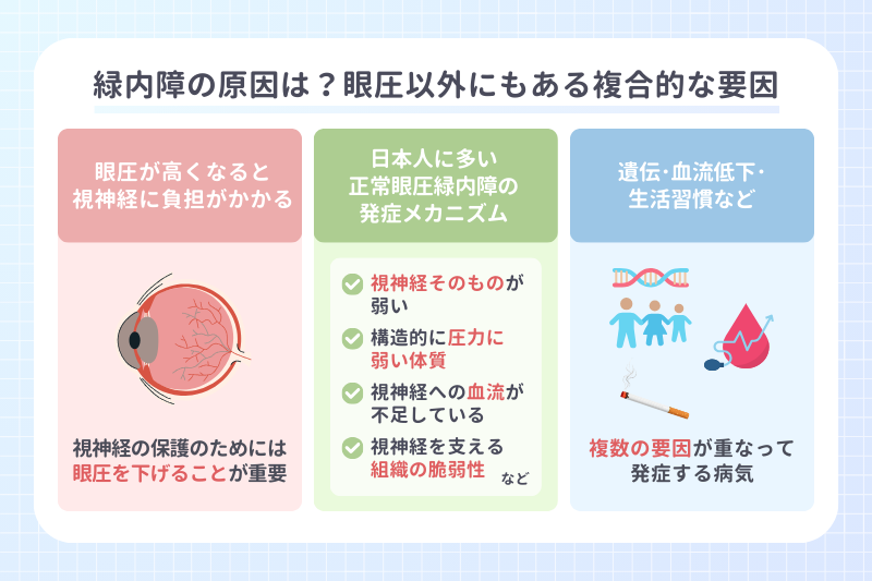 緑内障の原因は？眼圧以外にもある複合的な要因