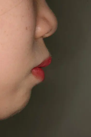 天神AN矯正歯科