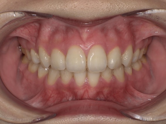 天神AN矯正歯科