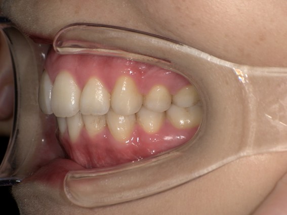 天神AN矯正歯科