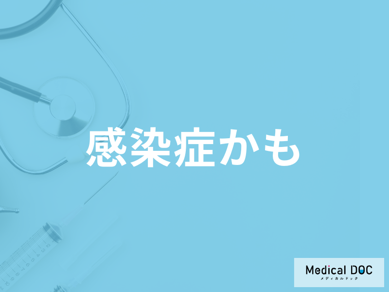 【インフルエンザ・コロナ】長引く咳の対処法はご存じですか? 予防法も医師が解説