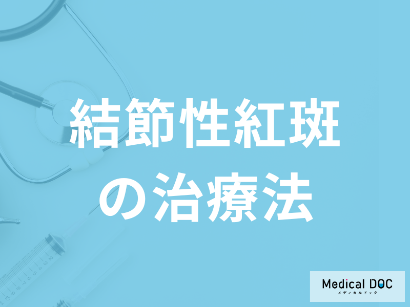 「結節性紅斑の治療法」はご存知ですか？治療期間についても医師が解説！