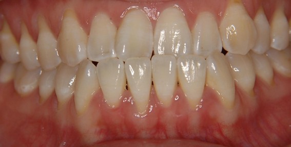 天神AN矯正歯科