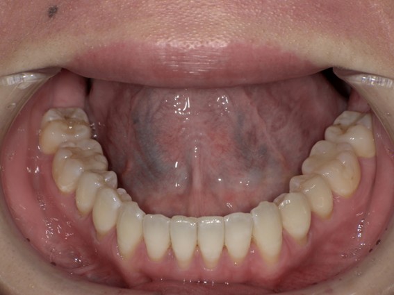 天神AN矯正歯科