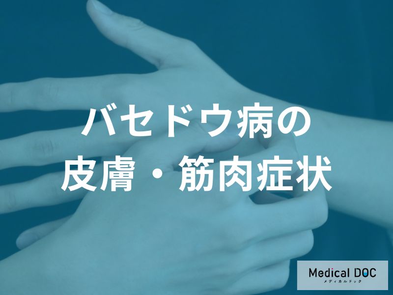 バセドウ病の身体変化とは?皮膚の湿潤や痒み、階段がつらい筋力低下などの症状
