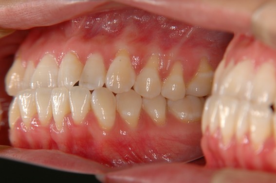 天神AN矯正歯科