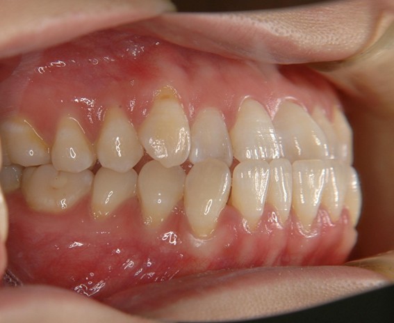 天神AN矯正歯科