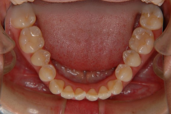 天神AN矯正歯科