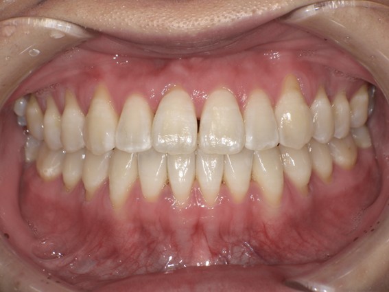 天神AN矯正歯科