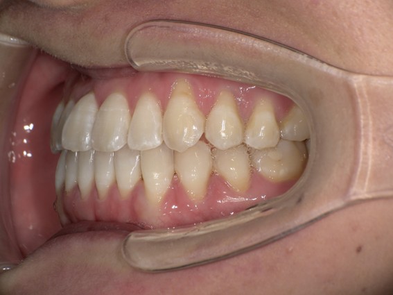 天神AN矯正歯科