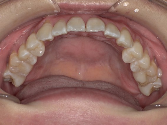 天神AN矯正歯科