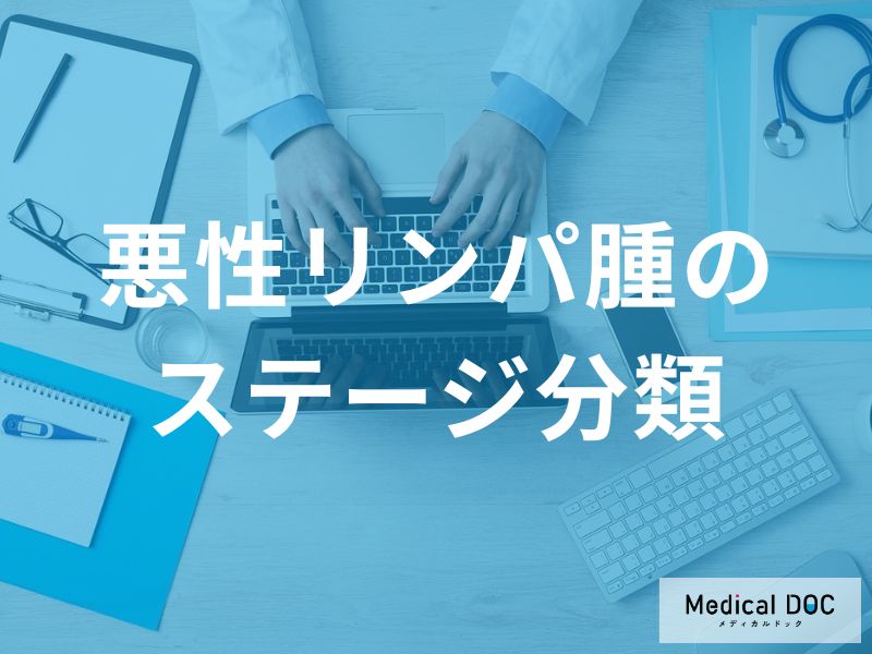 「悪性リンパ腫のステージごとの症状」はご存じですか？【医師監修】