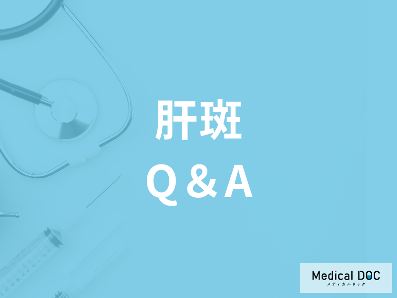 肝斑の治療費用はご存じですか? 放置して自然になることはある?【医師解説】