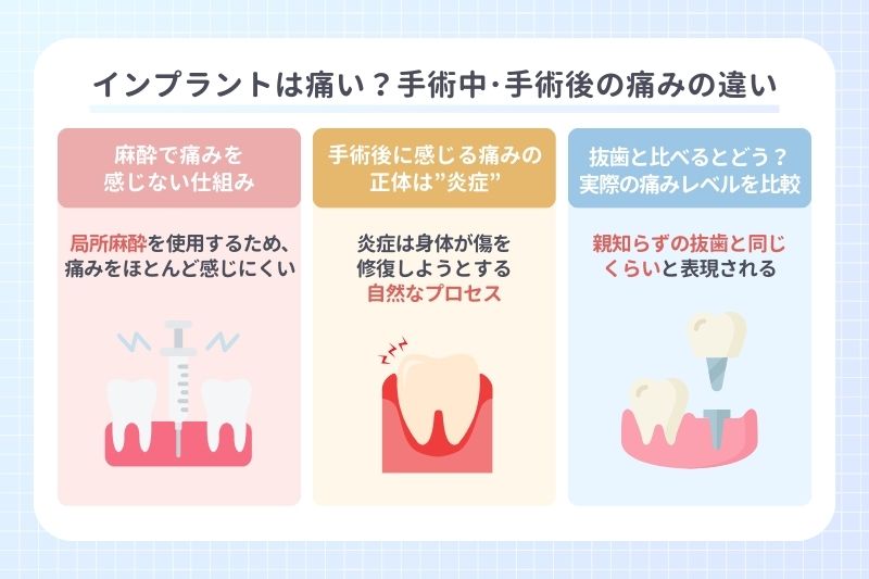 インプラントは痛い？手術中･手術後の痛みの違い