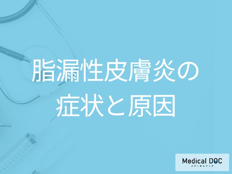 30~40代に多い「脂漏性皮膚炎」はどんな症状が現れる?原因も医師が解説!