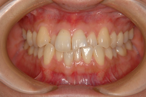 天神AN矯正歯科