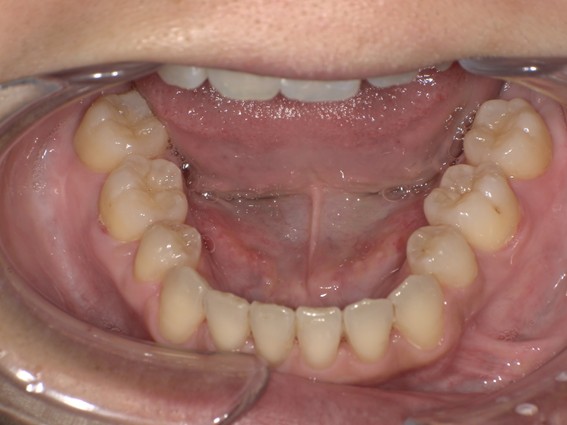 天神AN矯正歯科