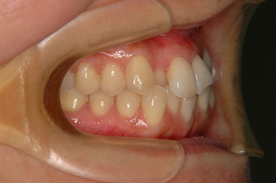 天神AN矯正歯科