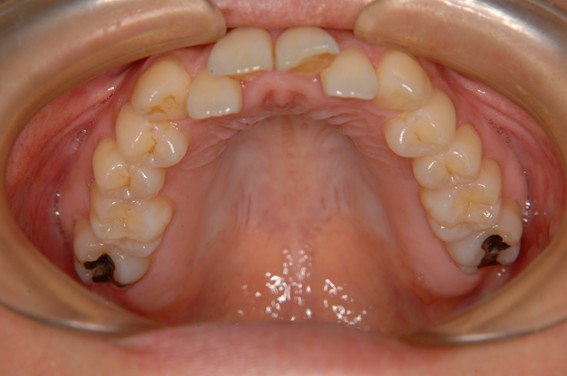 天神AN矯正歯科