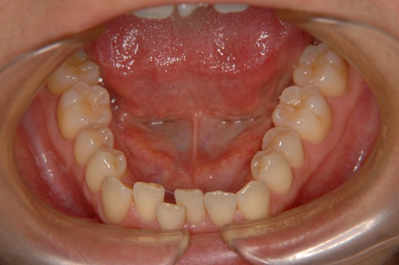 天神AN矯正歯科