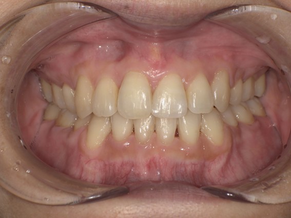 天神AN矯正歯科