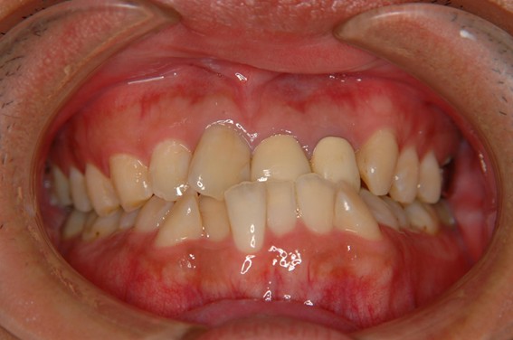 天神AN矯正歯科