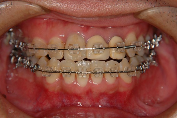 天神AN矯正歯科