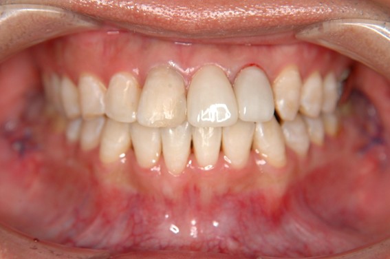 天神AN矯正歯科