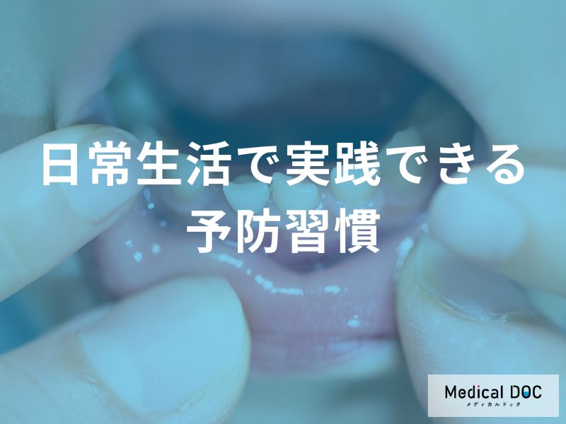 「赤ちゃんのむし歯予防」に食後何をすると良い？日常生活でできる予防法を解説！