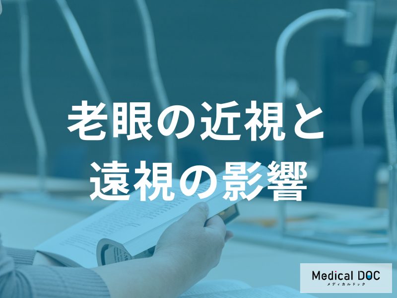 30代から始まる人も。遠視の老眼は進行が早い傾向あり！近視との違いと正しい矯正法