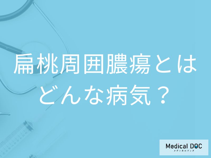 ”唾が飲めない喉の痛み”は扁桃周囲膿瘍のサイン?原因や発症しやすい人も医師が解説!