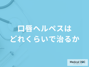 「口唇ヘルペスはどれくらいで治るか」ご存じですか？医師が徹底解説！