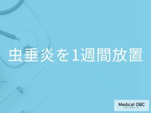 「虫垂炎を1週間放置」するとどうなるかご存知ですか？現れる症状も解説！