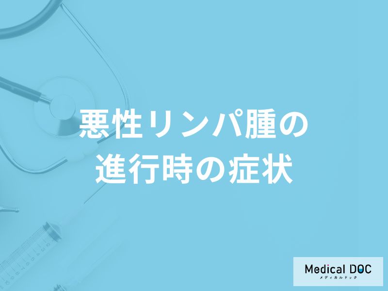 「悪性リンパ腫の進行時の症状」はご存知ですか?【医師監修】