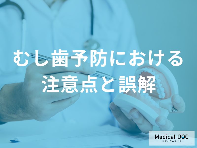 「むし歯予防における注意点」とは？乳歯とむし歯に関する誤解も解説！