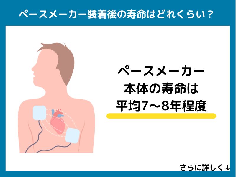 ペースメーカー装着後の寿命はどれくらい？
