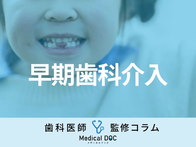 「子どもの歯並び」への『早期歯科介入』とは？ メリット・デメリットを歯科医が解説